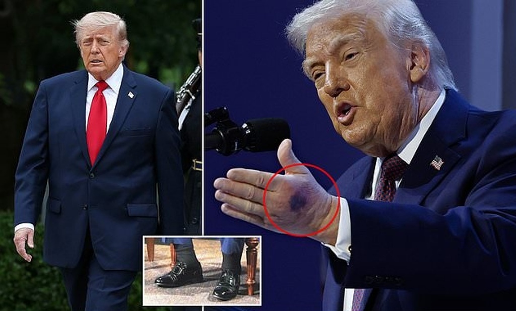 Trump’s Health Report Sparks Alarm as Vascular Surgeon Makes Ominous Claim